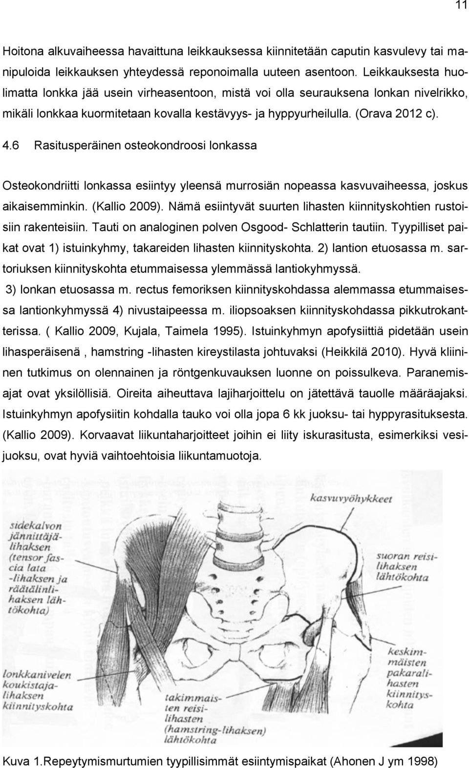 6 Rasitusperäinen osteokondroosi lonkassa Osteokondriitti lonkassa esiintyy yleensä murrosiän nopeassa kasvuvaiheessa, joskus aikaisemminkin. (Kallio 2009).