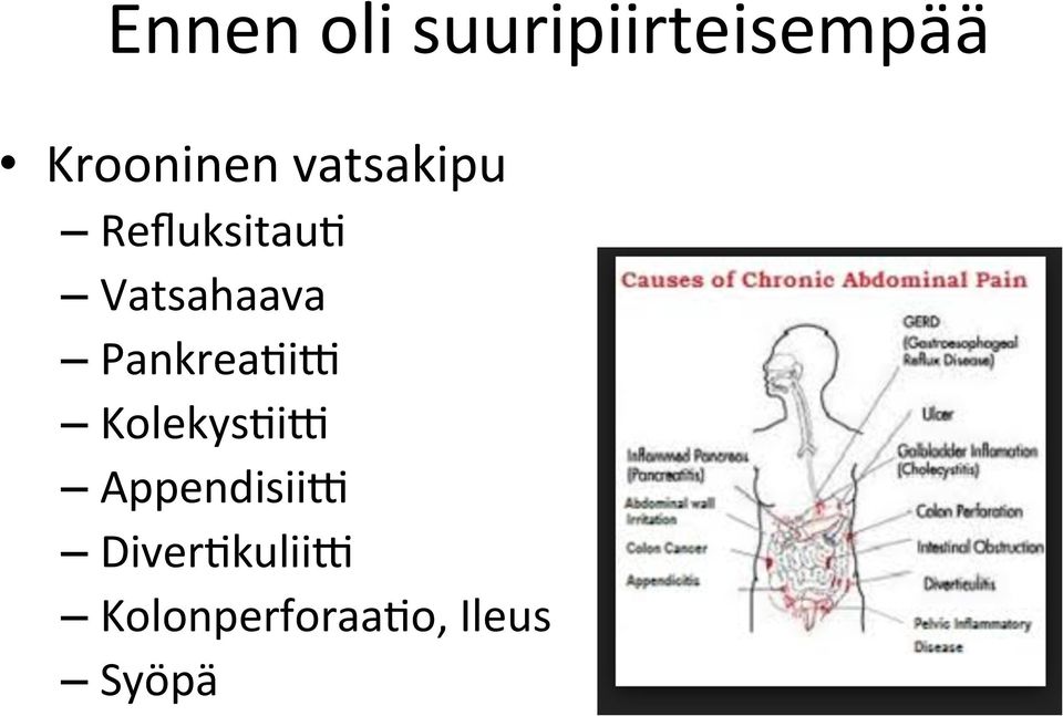 Vatsahaava PankreaAiR KolekysAiR