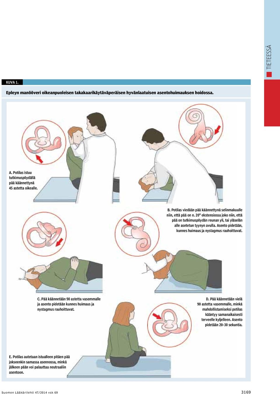 Asento pidetään, kunnes huimaus ja nystagmus rauhoittuvat. C. Pää käännetään 90 astetta vasemmalle ja asento pidetään kunnes huimaus ja nystagmus rauhoittuvat. D.
