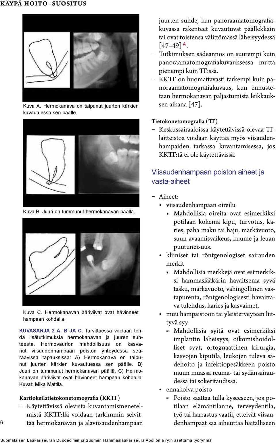 Tutkimuksen sädeannos on suurempi kuin panoraamatomografiakuvauksessa mutta pienempi kuin TT:ssä.