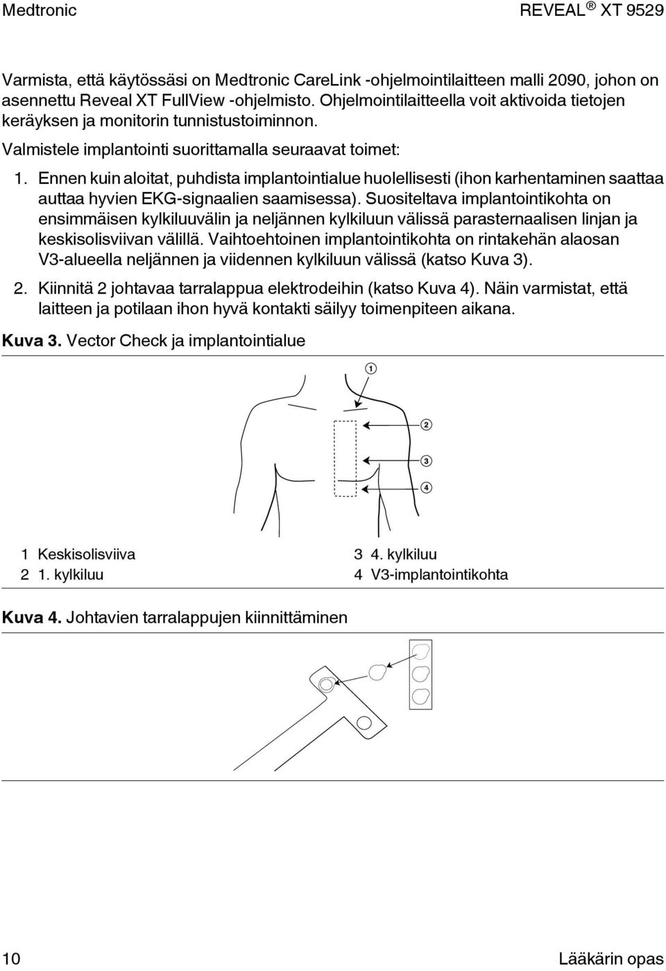 Ennen kuin aloitat, puhdista implantointialue huolellisesti (ihon karhentaminen saattaa auttaa hyvien EKG-signaalien saamisessa).