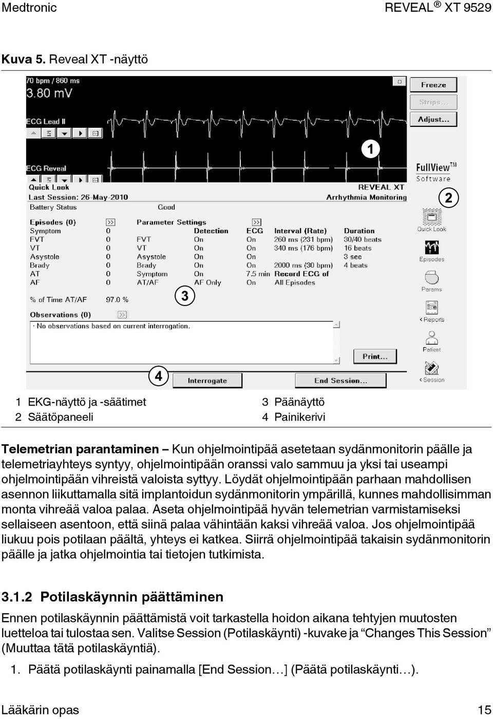 ohjelmointipään oranssi valo sammuu ja yksi tai useampi ohjelmointipään vihreistä valoista syttyy.