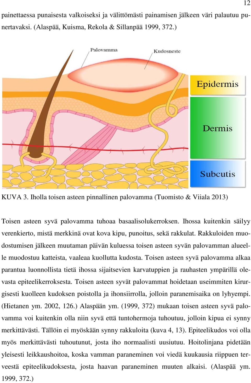 Ihossa kuitenkin säilyy verenkierto, mistä merkkinä ovat kova kipu, punoitus, sekä rakkulat.