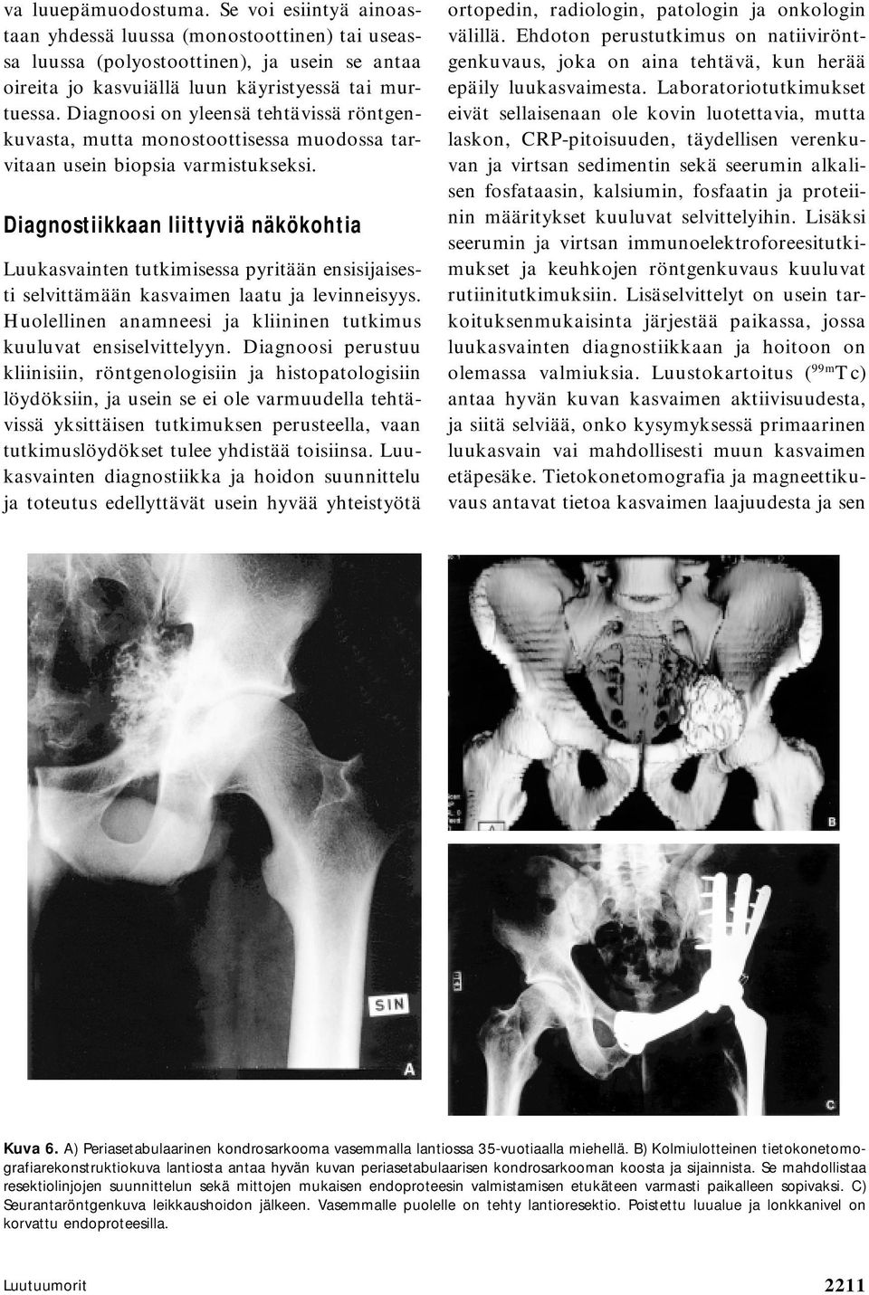 Diagnostiikkaan liittyviä näkökohtia Luukasvainten tutkimisessa pyritään ensisijaisesti selvittämään kasvaimen laatu ja levinneisyys.