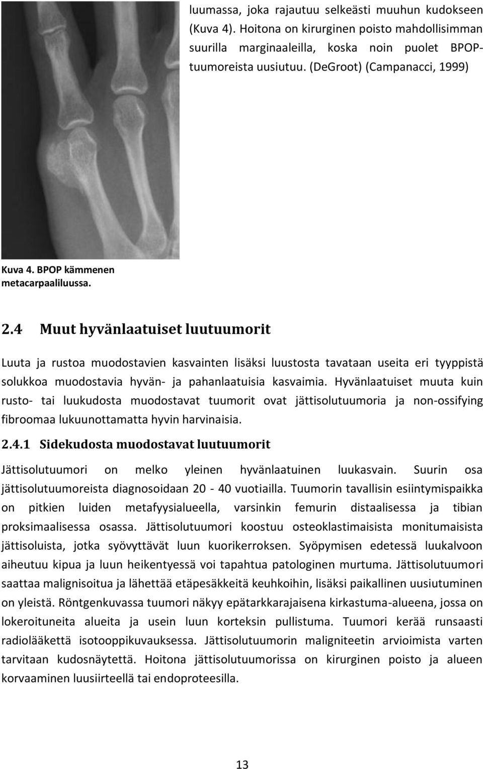 4 Muut hyvänlaatuiset luutuumorit Luuta ja rustoa muodostavien kasvainten lisäksi luustosta tavataan useita eri tyyppistä solukkoa muodostavia hyvän- ja pahanlaatuisia kasvaimia.