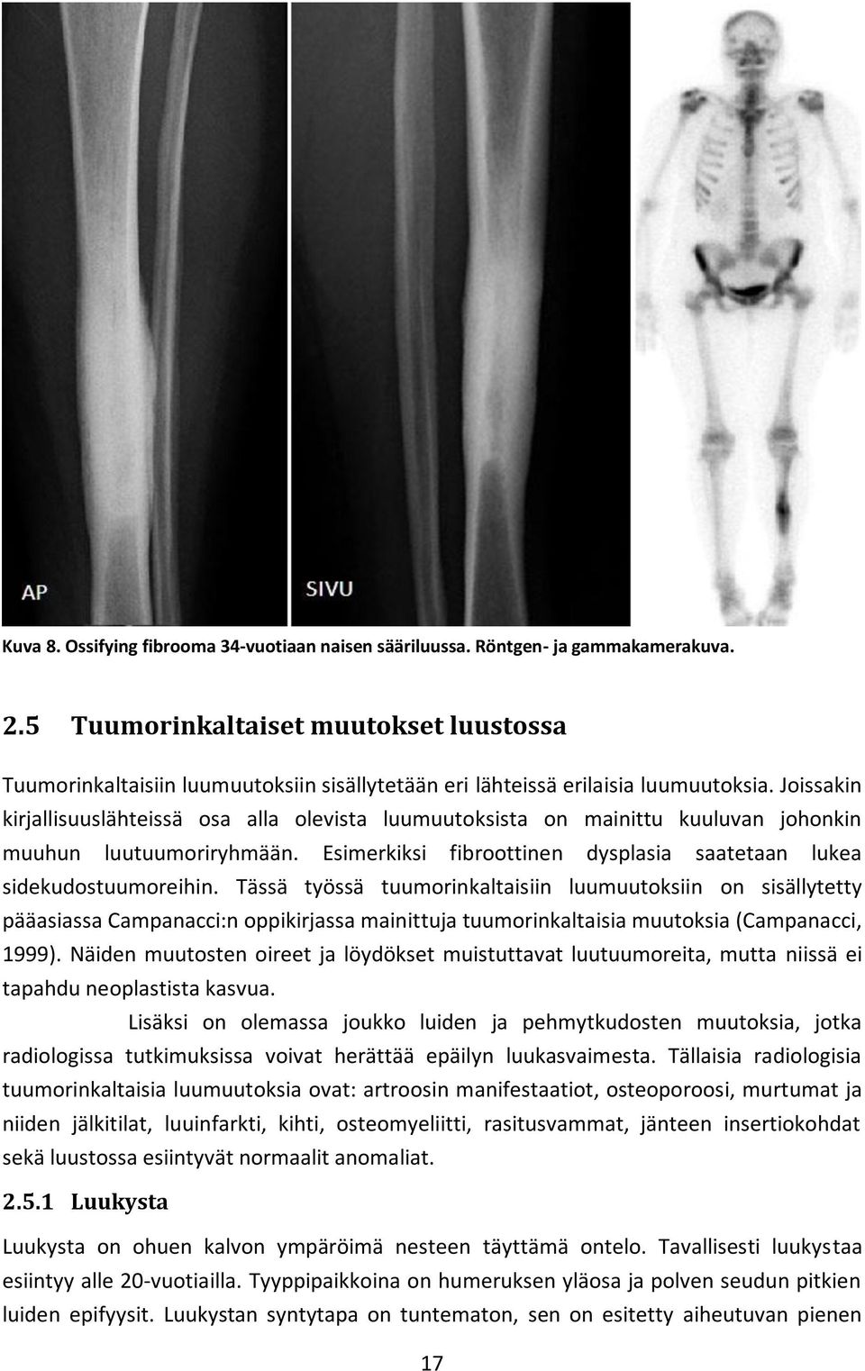 Joissakin kirjallisuuslähteissä osa alla olevista luumuutoksista on mainittu kuuluvan johonkin muuhun luutuumoriryhmään. Esimerkiksi fibroottinen dysplasia saatetaan lukea sidekudostuumoreihin.