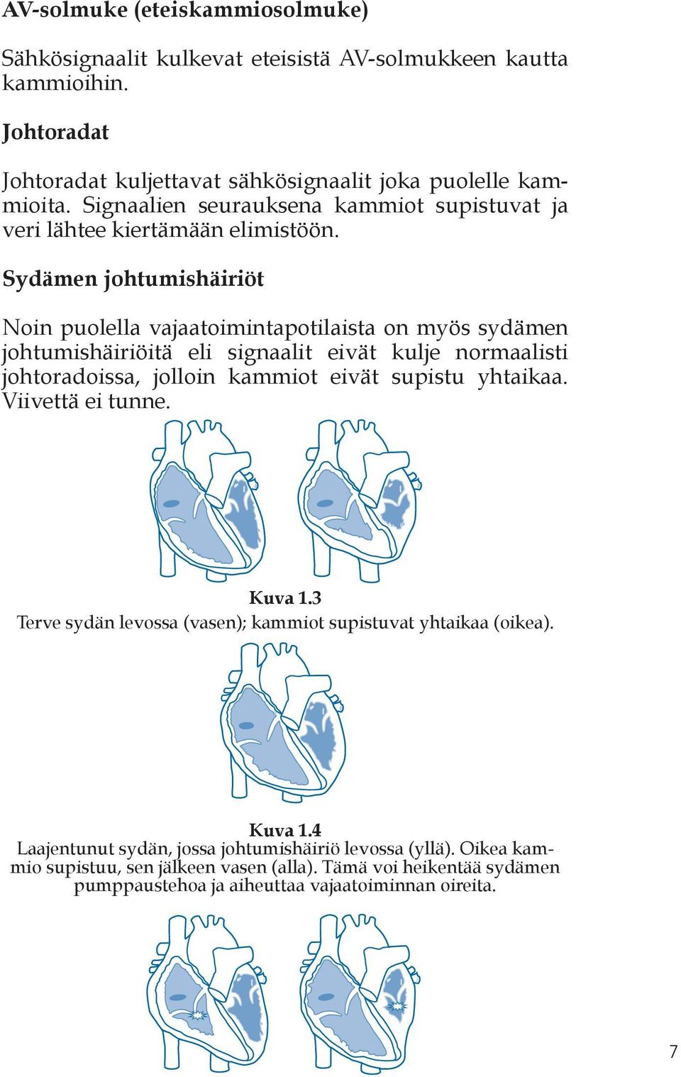Sydämen johtumishäiriöt Noin puolella vajaatoimintapotilaista on myös sydämen johtumishäiriöitä eli signaalit eivät kulje normaalisti johtoradoissa, jolloin kammiot eivät supistu