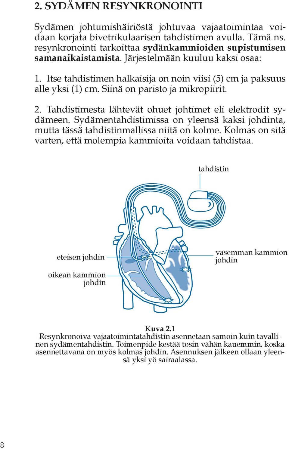 Siinä on paristo ja mikropiirit. 2. Tahdistimesta lähtevät ohuet johtimet eli elektrodit sydämeen. Sydämentahdistimissa on yleensä kaksi johdinta, mutta tässä tahdistinmallissa niitä on kolme.