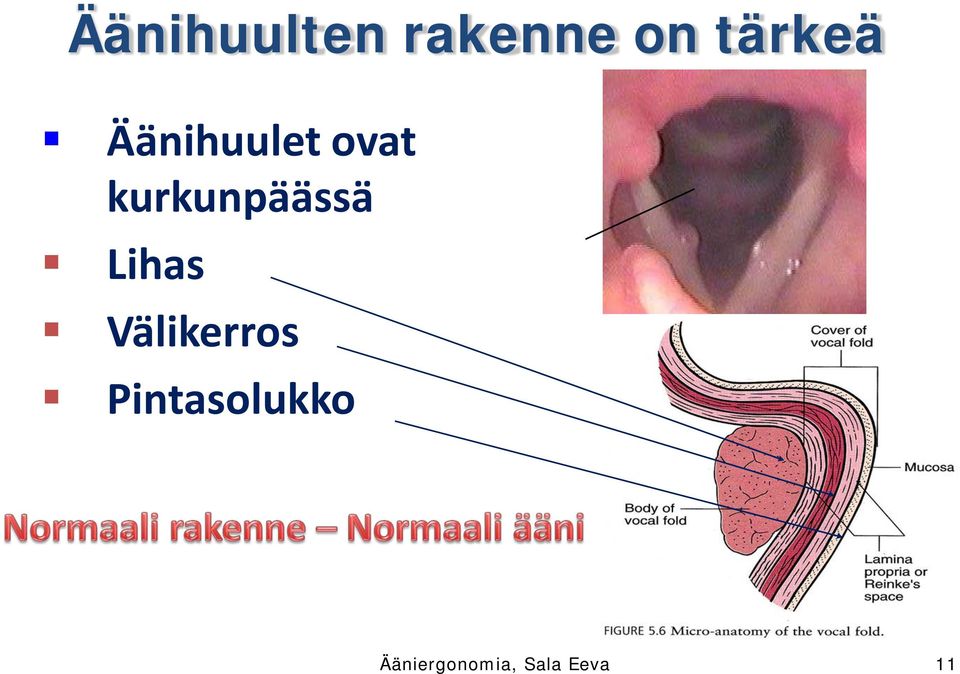 kurkunpäässä Lihas