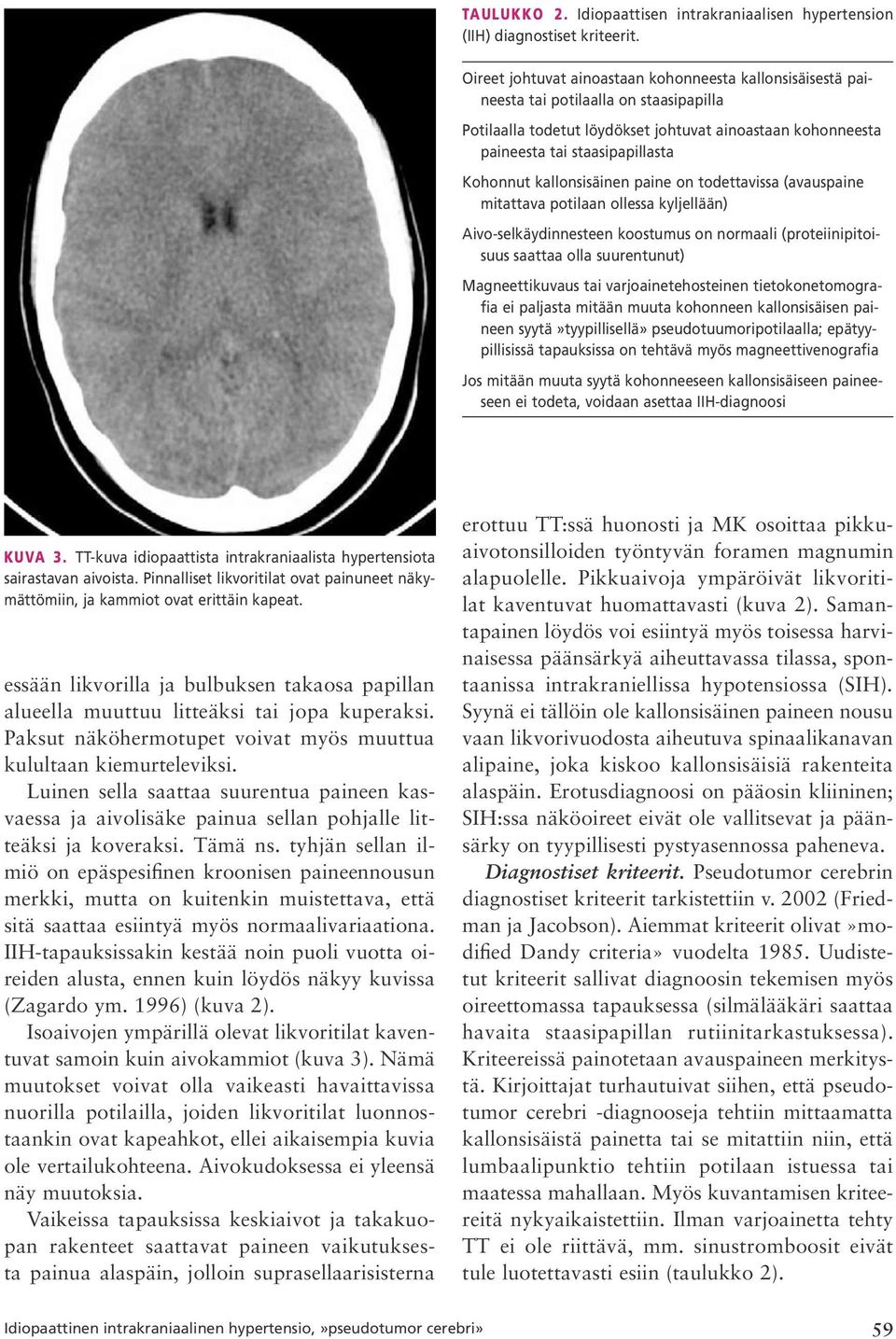 kallonsisäinen paine on todettavissa (avauspaine mitattava potilaan ollessa kyljellään) Aivo selkäydinnesteen koostumus on normaali (proteiinipitoisuus saattaa olla suurentunut) Magneettikuvaus tai