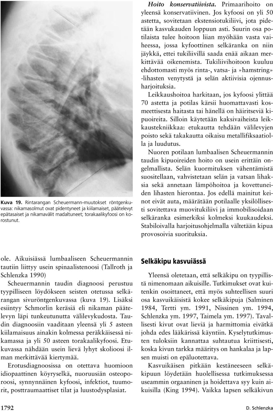 Suurin osa potilaista tulee hoitoon liian myöhään vasta vaiheessa, jossa kyfoottinen selkäranka on niin jäykkä, ettei tukiliivillä saada enää aikaan merkittävää oikenemista.