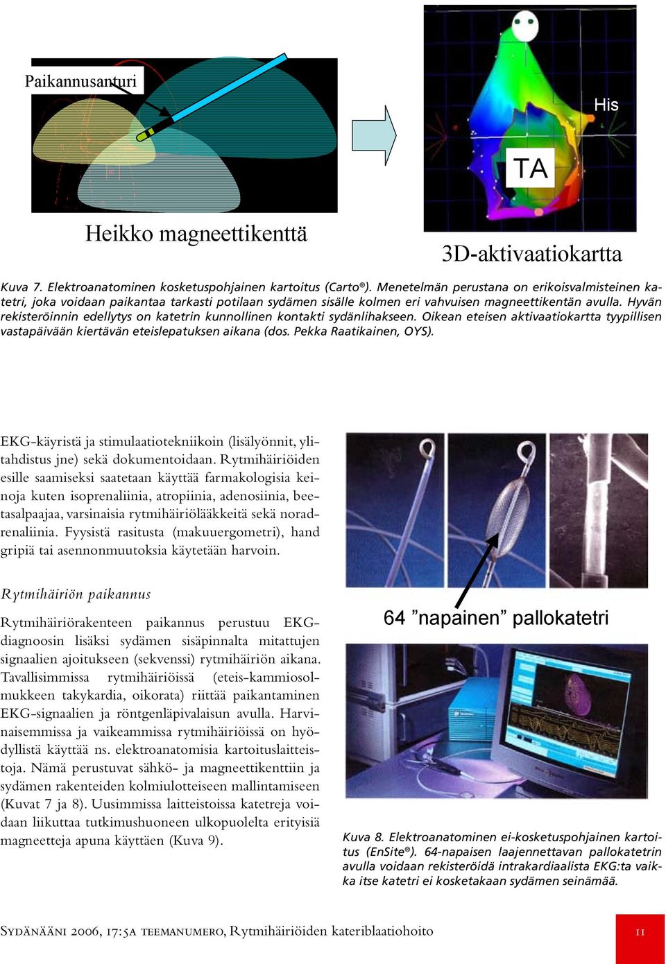 Hyvän rekisteröinnin edellytys on katetrin kunnollinen kontakti sydänlihakseen. Oikean eteisen aktivaatiokartta tyypillisen vastapäivään kiertävän eteislepatuksen aikana (dos. Pekka Raatikainen, OYS).