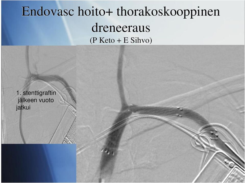 dreneeraus (P Keto + E