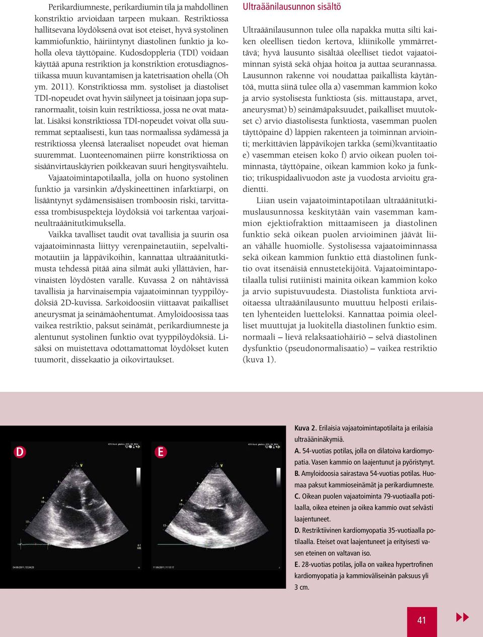 Kudosdoppleria (TDI) voidaan käyttää apuna restriktion ja konstriktion erotusdiagnostiikassa muun kuvantamisen ja katetrisaation ohella (Oh ym. 2011). Konstriktiossa mm.