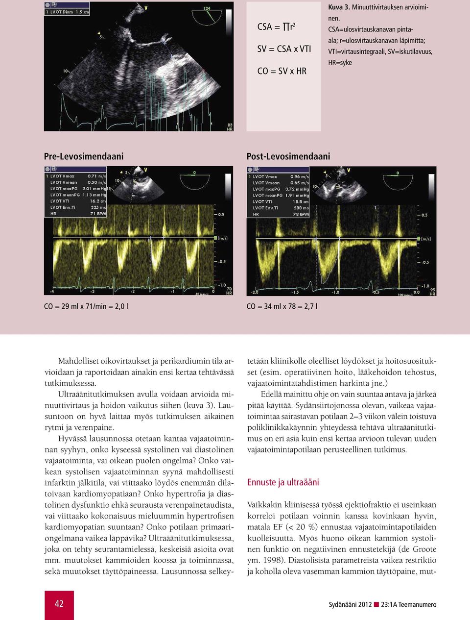 2,7 l Mahdolliset oikovirtaukset ja perikardiumin tila arvioidaan ja raportoidaan ainakin ensi kertaa tehtävässä tutkimuksessa.