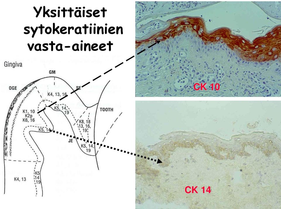 vasta-aineet CK