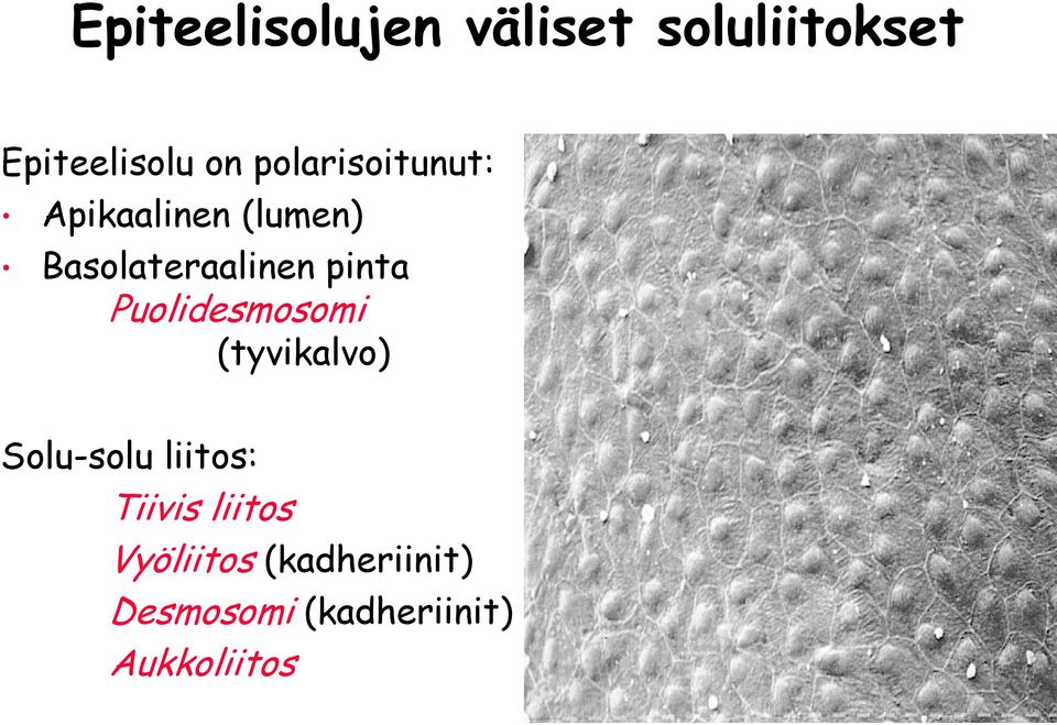 liitos: Tiivis liitos Vyöliitos (kadheriinit) Desmosomi (kadheriinit)