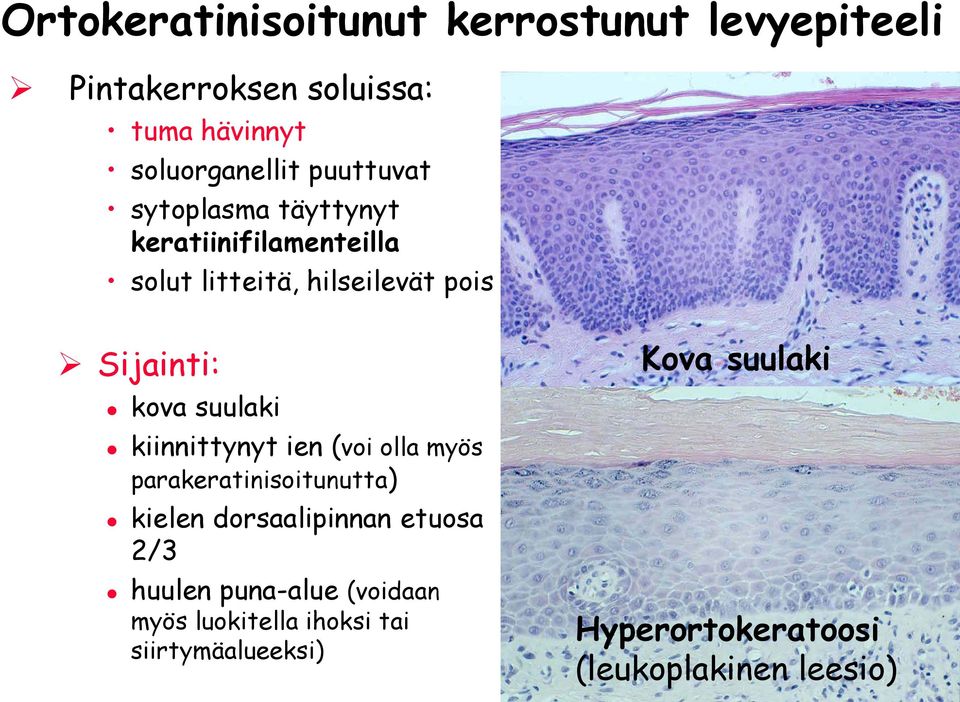 suulaki kiinnittynyt ien (voi olla myös parakeratinisoitunutta) kielen dorsaalipinnan etuosa 2/3 huulen