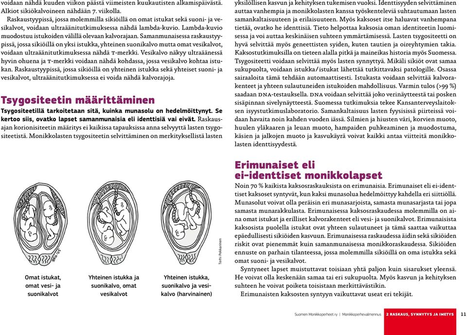 Samanmunaisessa raskaustyypissä, jossa sikiöillä on yksi istukka, yhteinen suonikalvo mutta omat vesikalvot, voidaan ultraäänitutkimuksessa nähdä t-merkki.