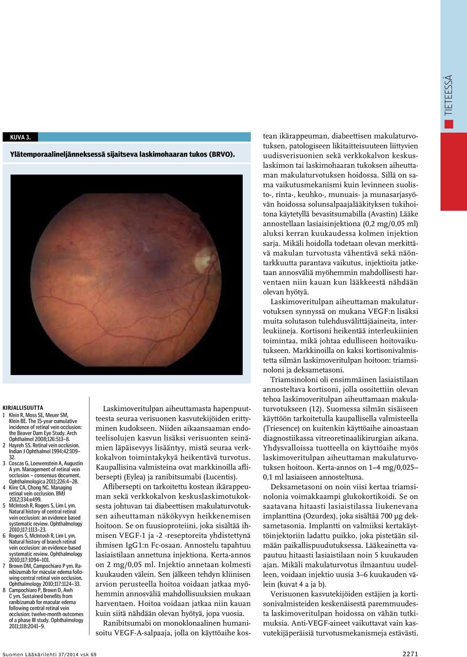 3 Coscas G, Loewenstein A, Augustin A ym. Management of retinal vein occlusion consensus document. Ophthalmologica 2011;226:4 28. 4 Kiire CA, Chong NC. Managing retinal vein occlusion.