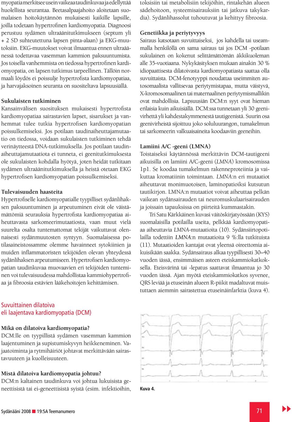 Diagnoosi perustuu sydämen ultraäänitutkimukseen (septum yli + 2 SD suhteutettuna lapsen pinta-alaan) ja EKG-muutoksiin.