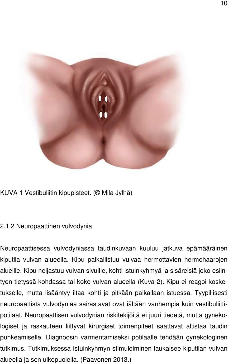 Kipu ei reagoi kosketukselle, mutta lisääntyy iltaa kohti ja pitkään paikallaan istuessa. Tyypillisesti neuropaattista vulvodyniaa sairastavat ovat iältään vanhempia kuin vestibuliittipotilaat.