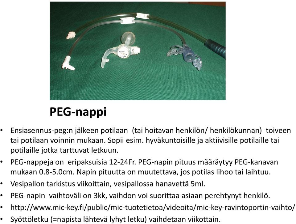 PEG-napin pituus määräytyy PEG-kanavan mukaan 0.8-5.0cm. Napin pituutta on muutettava, jos potilas lihoo tai laihtuu.