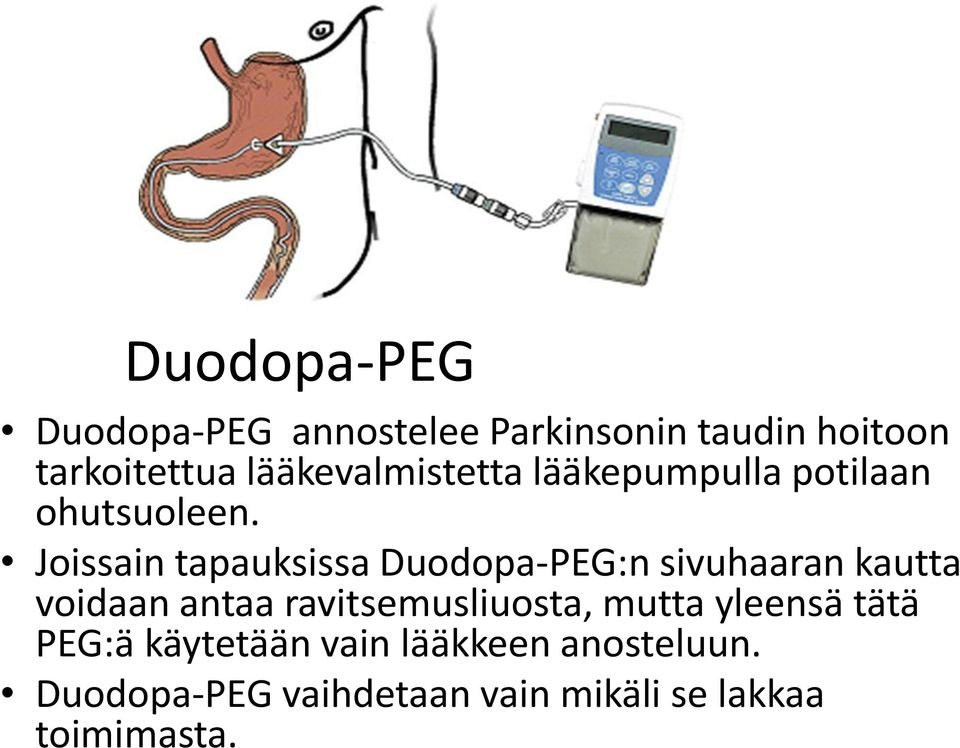 Joissain tapauksissa Duodopa-PEG:n sivuhaaran kautta voidaan antaa