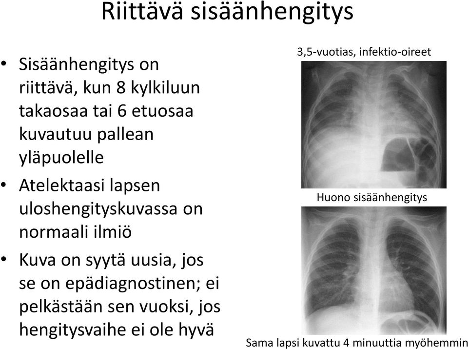 on syytä uusia, jos se on epädiagnostinen; ei pelkästään sen vuoksi, jos hengitysvaihe ei