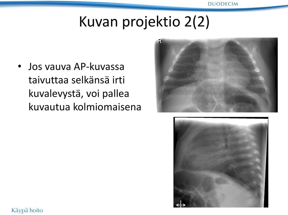 selkänsä irti kuvalevystä,