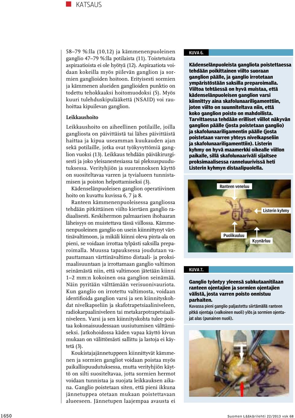 Myös kuuri tulehduskipulääkettä (NSAID) voi rauhoittaa kipuilevan ganglion.