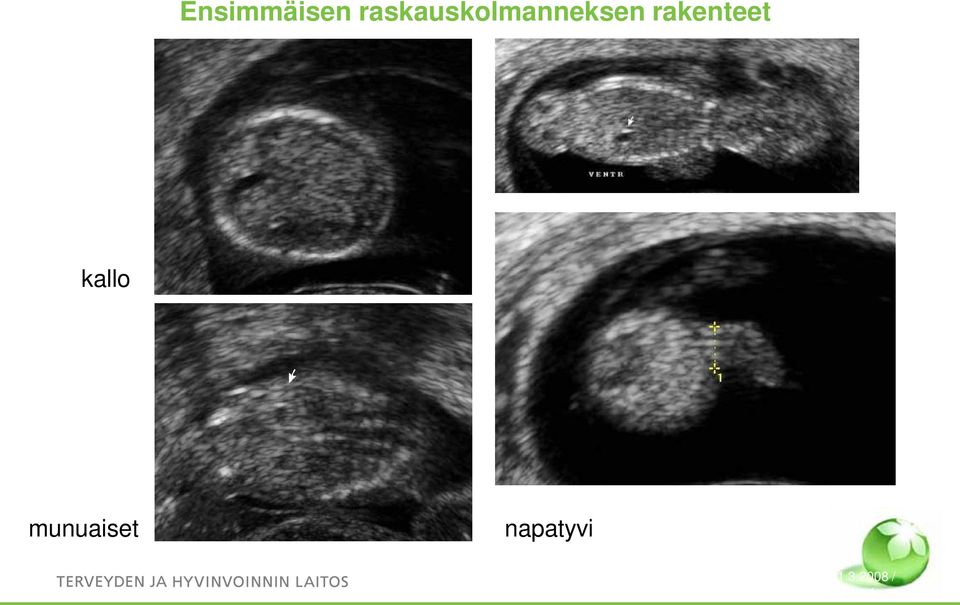 Ordén 19 Ensimmäisen