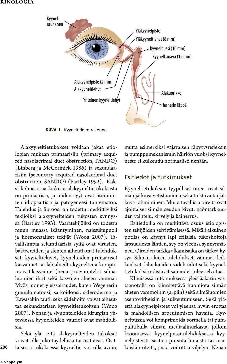 06 Alakyyneltietukokset voidaan jakaa etiologian mukaan primaarisiin (primary acquired nasolacrimal duct obstruction, PANDO) (Linberg ja McCormick 1986) ja sekundaarisiin (seconcary acquired