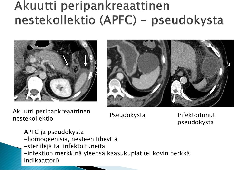 tai infektoituneita -infektion merkkinä yleensä