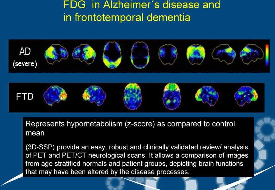 analysis of PET and PET/CT neurological scans.