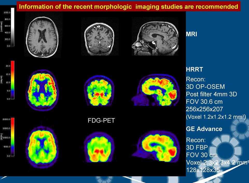 0 Recon: 3D OP-OSEM Post filter 4mm 3D FOV 30.6 cm 256x256x207 10.0 5.0 0.0 20000.