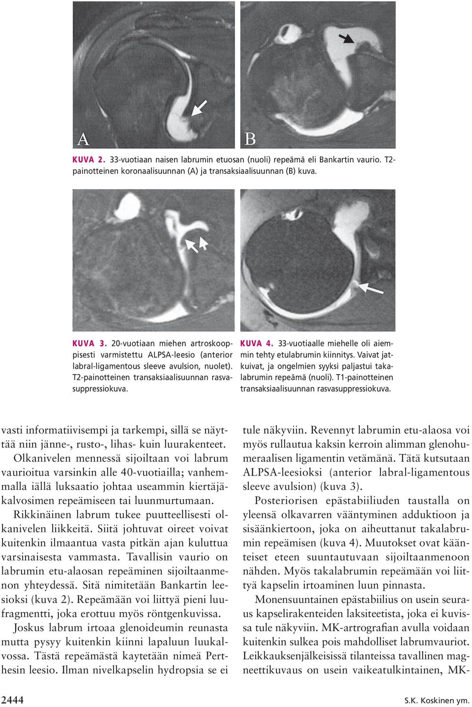 vasti informatiivisempi ja tarkempi, sillä se näyttää niin jänne-, rusto-, lihas- kuin luurakenteet.