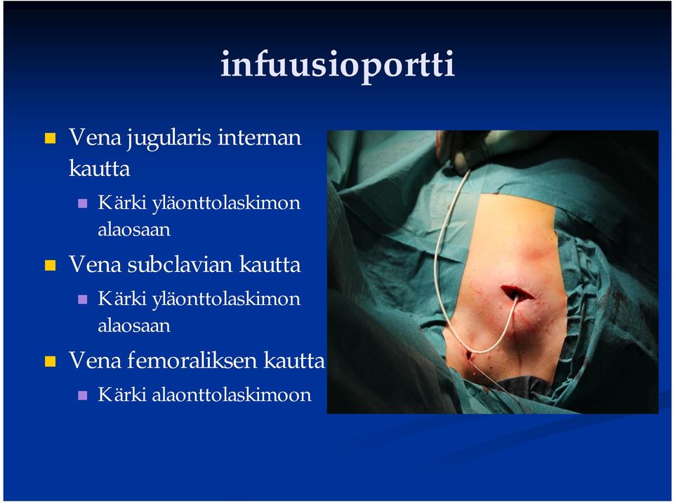 subclavian kautta  femoraliksen kautta Kärki