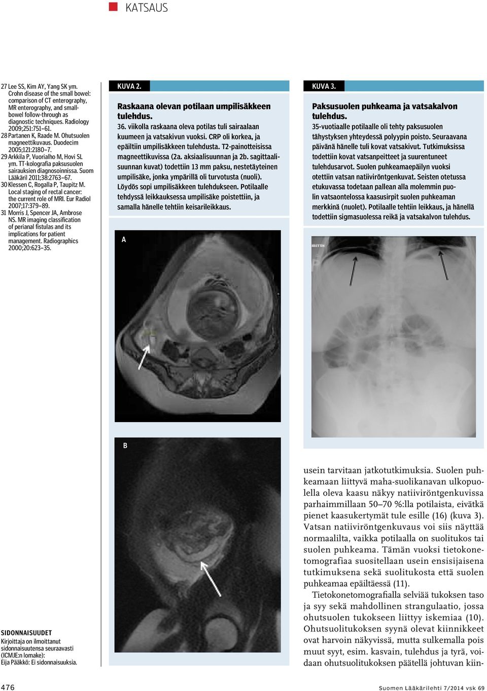 Suom Lääkäril 2011;38:2763 67. 30 Klessen C, Rogalla P, Taupitz M. Local staging of rectal cancer: the current role of MRI. Eur Radiol 2007;17:379 89. 31 Morris J, Spencer JA, Ambrose NS.