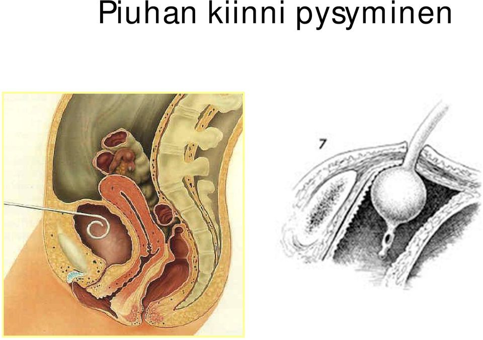 pysyminen