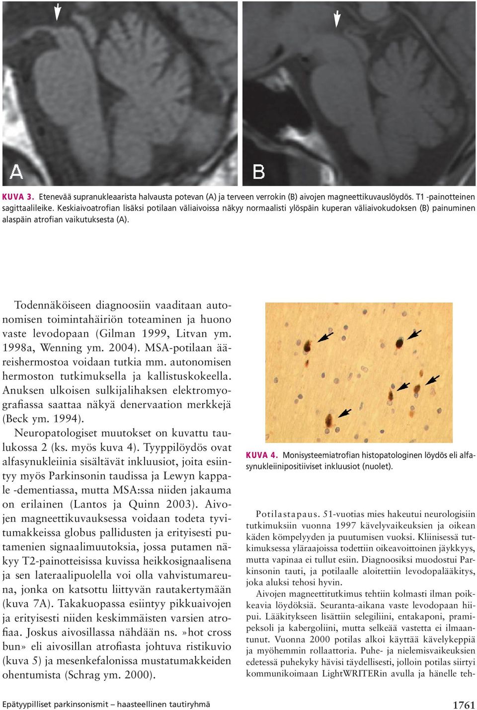 Todennäköiseen diagnoosiin vaaditaan autonomisen toimintahäiriön toteaminen ja huono vaste levodopaan (Gilman 1999, Litvan ym. 1998a, Wenning ym. 2004). MSA-potilaan ääreishermostoa voidaan tutkia mm.