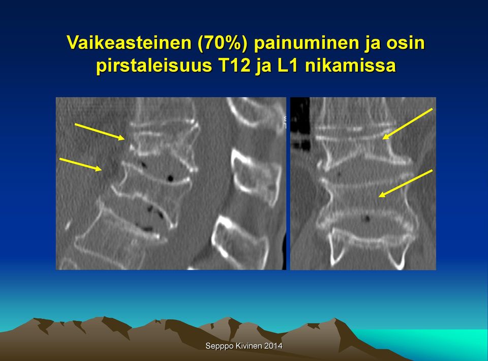 ja osin