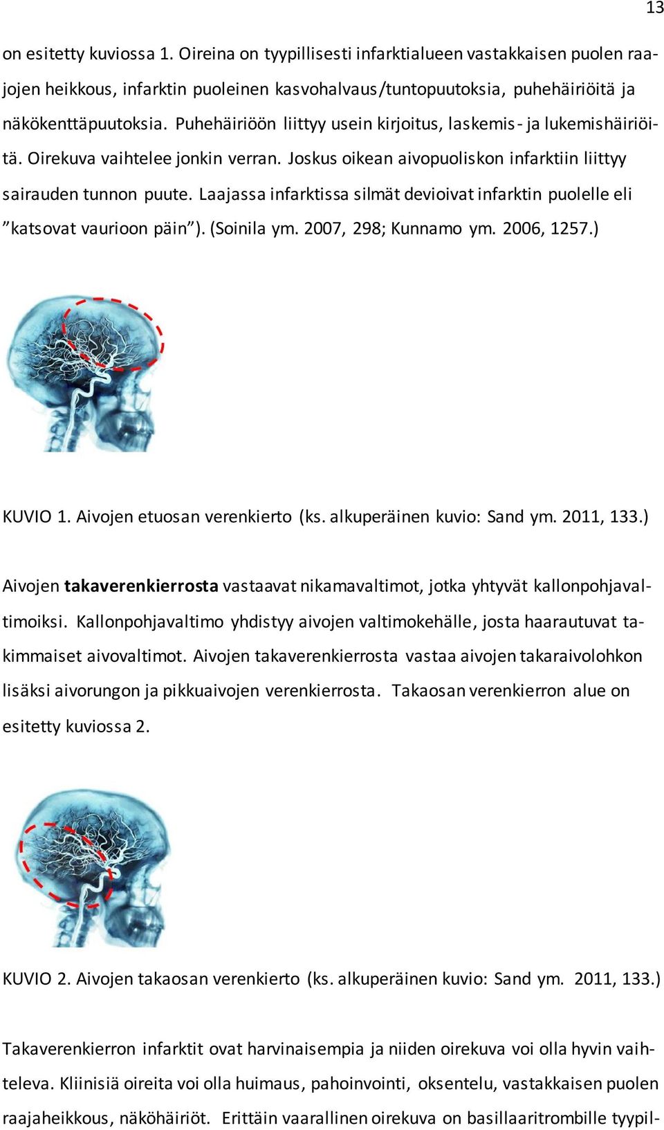 Laajassa infarktissa silmät devioivat infarktin puolelle eli katsovat vaurioon päin ). (Soinila ym. 2007, 298; Kunnamo ym. 2006, 1257.) KUVIO 1. Aivojen etuosan verenkierto (ks.