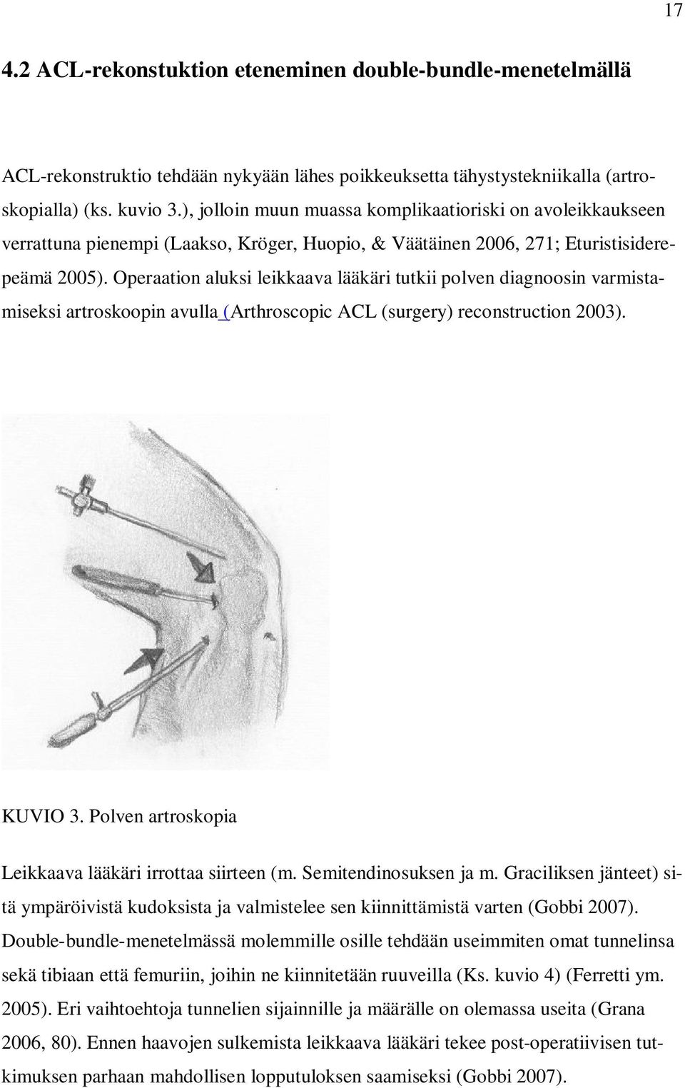 Operaation aluksi leikkaava lääkäri tutkii polven diagnoosin varmistamiseksi artroskoopin avulla (Arthroscopic ACL (surgery) reconstruction 2003). KUVIO 3.