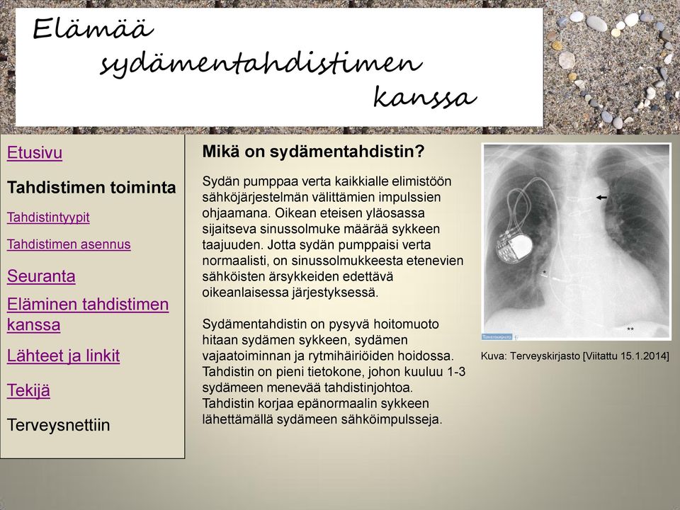 Jotta sydän pumppaisi verta normaalisti, on sinussolmukkeesta etenevien sähköisten ärsykkeiden edettävä oikeanlaisessa järjestyksessä.