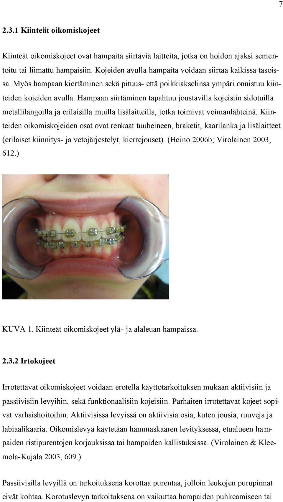 Hampaan siirtäminen tapahtuu joustavilla kojeisiin sidotuilla metallilangoilla ja erilaisilla muilla lisälaitteilla, jotka toimivat voimanlähteinä.