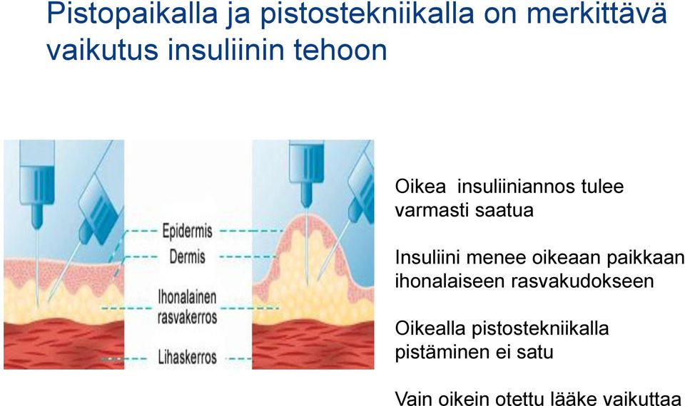 Insuliini menee oikeaan paikkaan ihonalaiseen rasvakudokseen