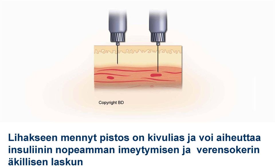 insuliinin nopeamman