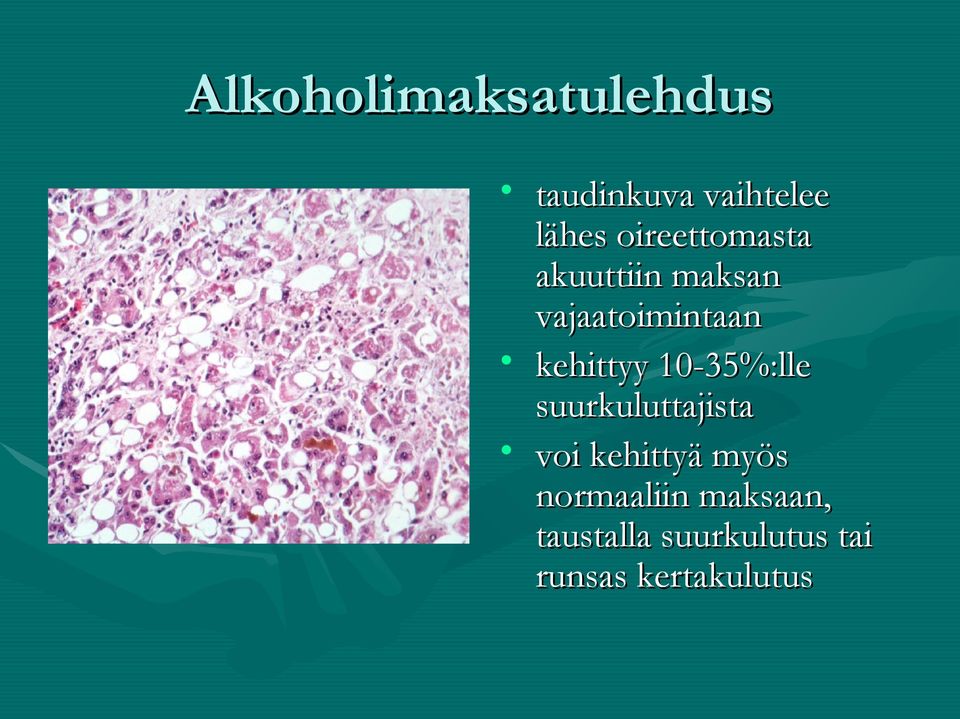 kehittyy 10-35%:lle suurkuluttajista voi kehittyä