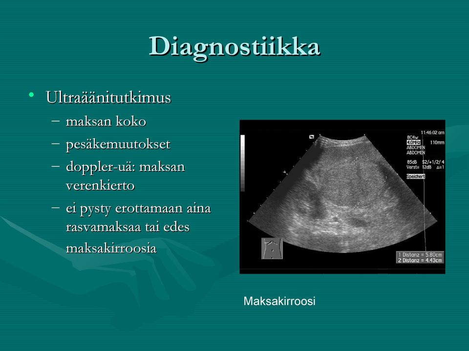 doppler-uä: maksan verenkierto ei pysty